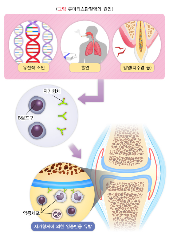 /자료=국가건강정보포털
