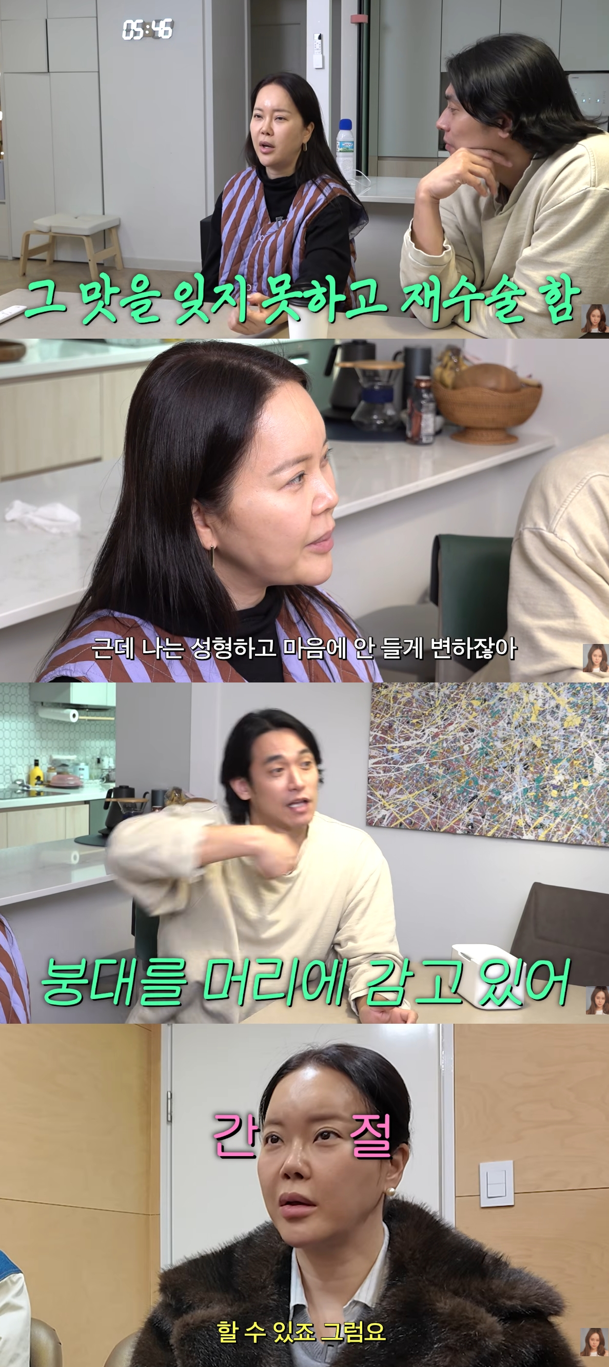 가수 백지영이 코 성형수술 부작용을 토로했다. /사진=유튜브 영상 갈무리