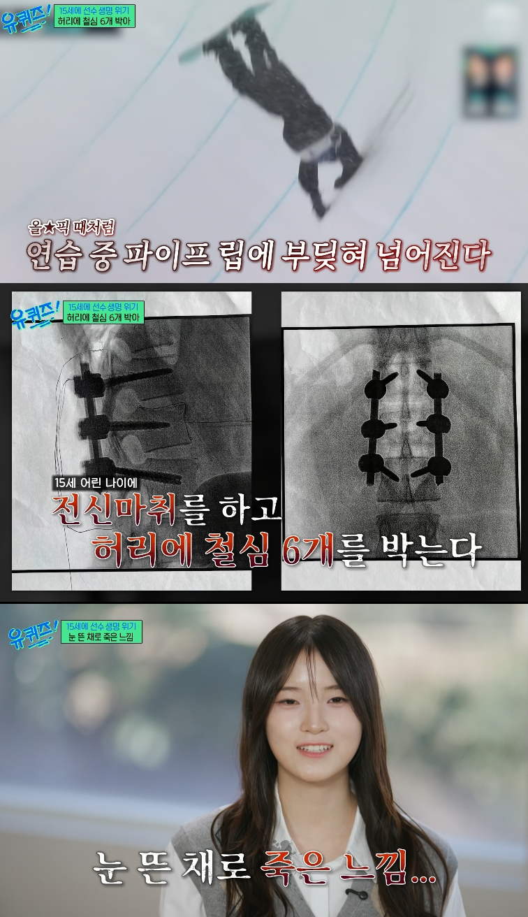설상 종목 대한민국 최초의 금메달을 딴 스노보드 선수 최가온이 끔찍했던 부상에 대해 털어놨다. /사진=tvN '유 퀴즈 온 더 블럭'
