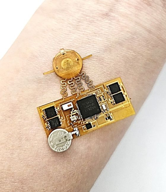 AI 결합 전자패치 개발/사진=카이스트