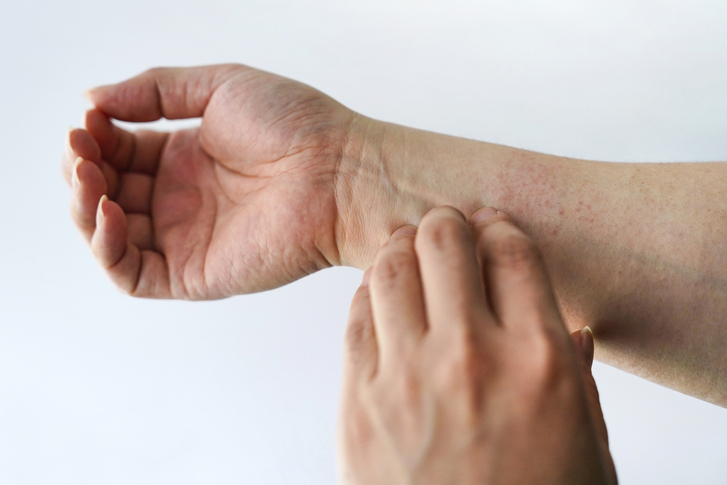 사진은 기사 이해를 돕기 위한 것으로 실제 감염병 증상과 다를 수 있음. /사진=게티이미지뱅크