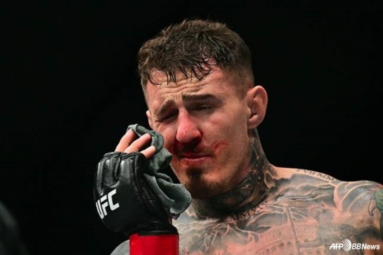 톰 아스피날이 시릴 가네와 경기 중 눈을 찡그리며 고통스러워하고 있다. /AFPBBNews=뉴스1