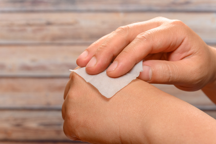 세균에 감염된 '상처 치료용 물티슈'를 사용했다가 사망에 이를 수 있다는 경고가 나왔다. 사진과 기사 내용은 직접적인 관련이 없음./사진=게티이미지뱅크.