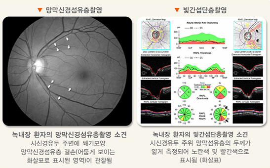/자료=국가건강정보포털