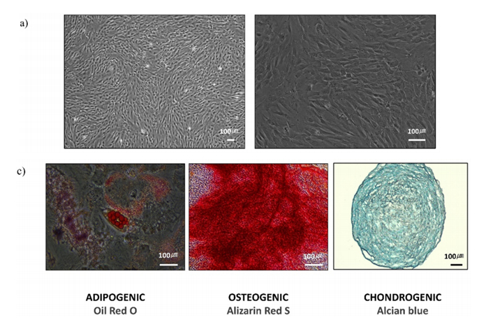 마스터 세포 은행 시스템 과정 이미지. (A) 바이오리액터(생물반응기) 내에서 배양된 줄기세포의 실제 모습. 수동 배양이 아닌 자동화 시스템을 통해 세포가 건강하게 증식했음을 보여준다. (C) 이렇게 증식한 세포가 실제로 지방, 뼈, 연골 등으로 잘 변하는지 확인한 사진으로 대량 생산 후에도 재생 기능(품질)이 완벽함을 보여준다.