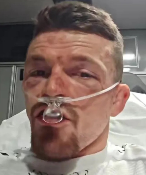 병원에 실려간 해리 하드윅. /사진=더선 갈무리