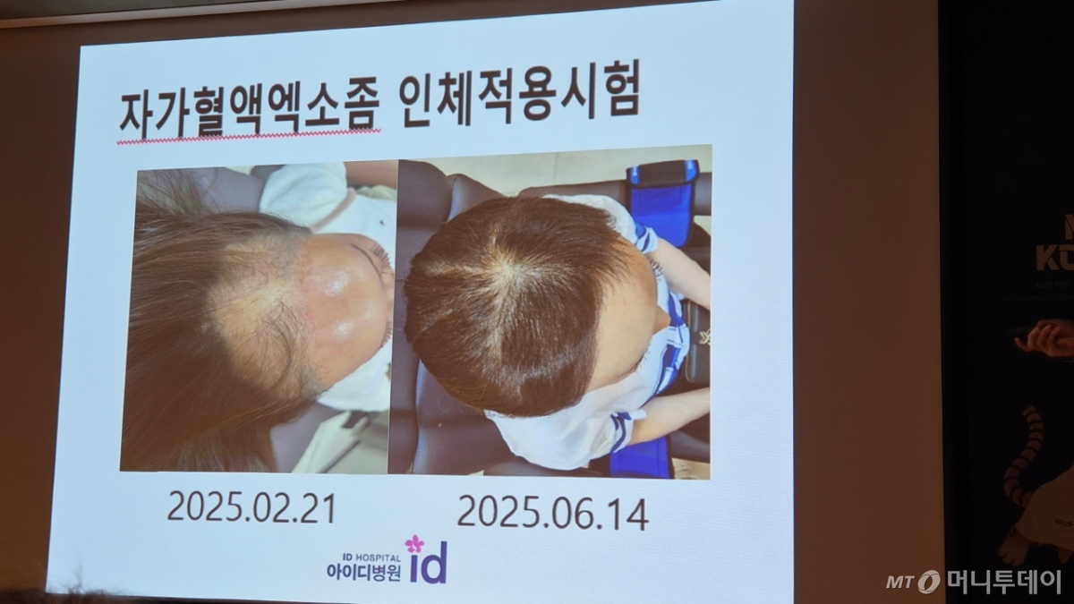 오한진 아이디병원 밸런스센터 VIP센터 줄기세포센터장 발표자료/사진= 박미주 기자