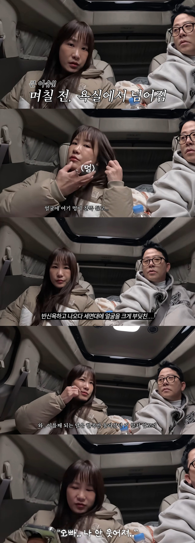 개그우먼 김지민이 욕실 낙상 사고로 다친 얼굴을 공개했다./사진=유튜브 채널 '준호 지민' 영상