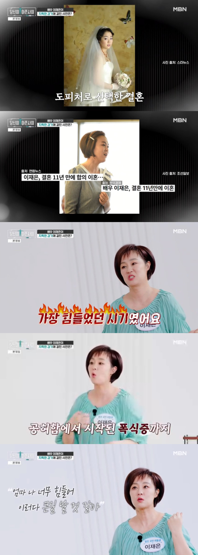 배우 이재은이 파란만장했던 인생사를 털어놨다./사진=MBN '당신이 아픈 사이' 방송 화면