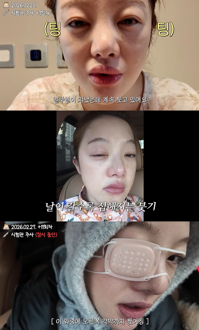 배우 황보라가 시험관 시술 과정에서 심각한 부작용을 겪었다고 털어놨다./사진=유튜브 채널 '황보라 보라이어티'