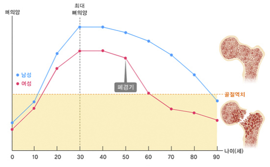 최대 골량의 형성과 나이에 따른 뼈의 감소. /자료=국가건강정보포털