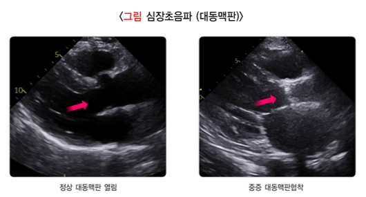 /자료=국가건강정보포털