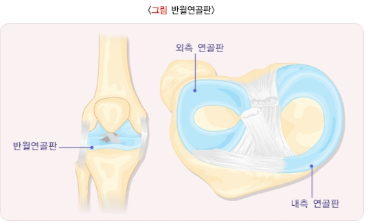 /자료=국가건강정보포털
