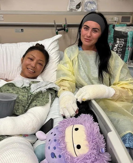 화상 사고로 치료를 받은 제이니 리(왼쪽)와 카일리 마리 월튼. /사진=더선 갈무리