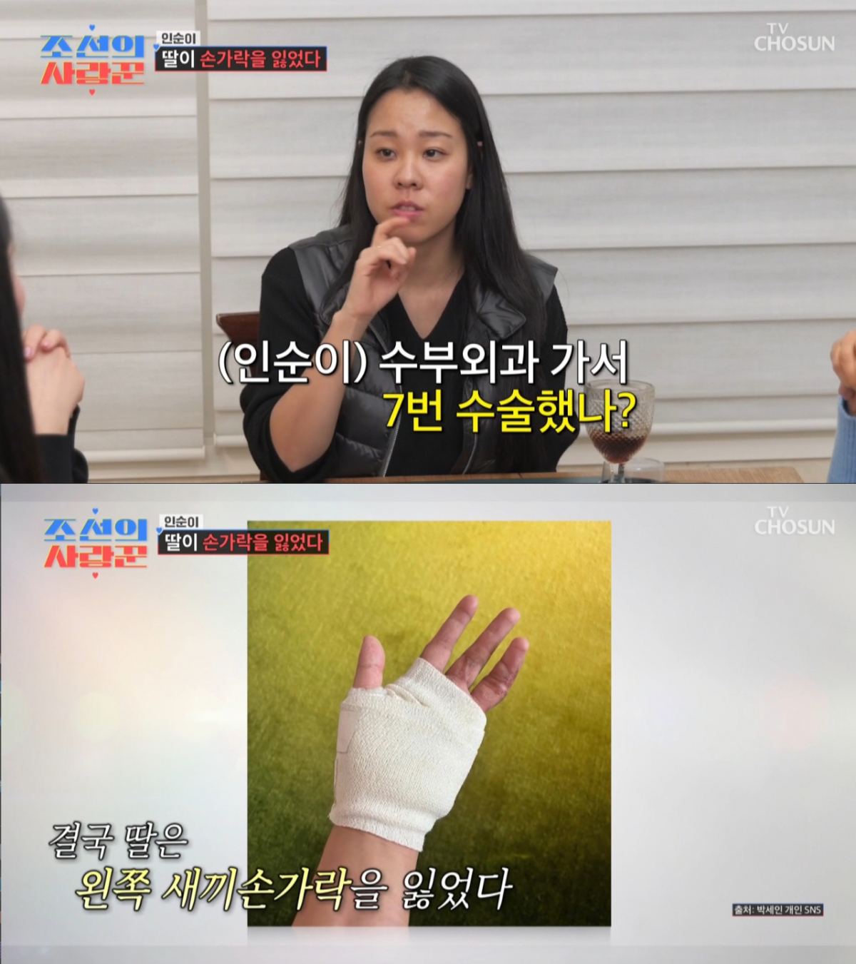 사고로 새끼손가락을 잃은 인순이 딸 박세인. /사진=TV조선 '조선의 사랑꾼' 캡처