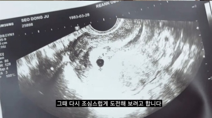 미국 변호사 겸 방송인 서동주가 계류유산했다는 소식을 전했다. /사진=유튜브 채널 '서동주의 또.도.동' 영상