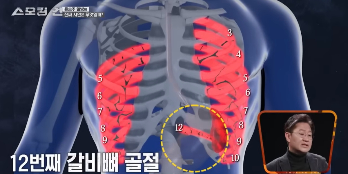 /사진=KBS2 '스모킹건'