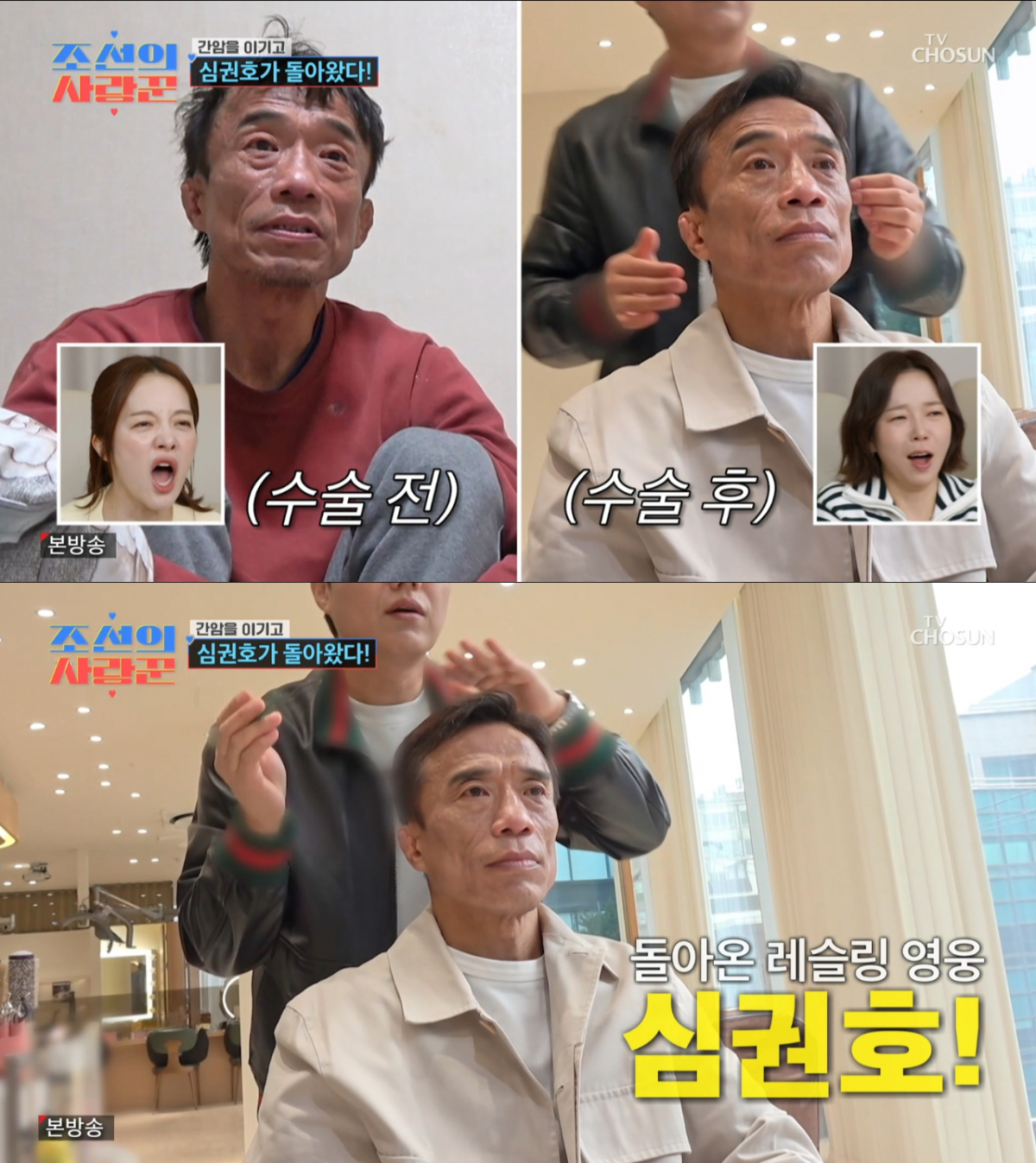 간암 수술 후 회복한 심권호. /사진=TV조선 '조선의 사랑꾼' 캡처