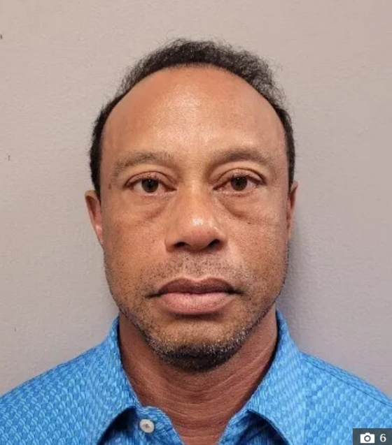 경찰 체포 직후 공개된 타이거 우즈의 머그샷. /사진=더선 갈무리