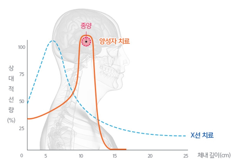 양성자 치료의 핵심 원리인 브래그피크를 설명한 그래프. /자료=삼성서울병원