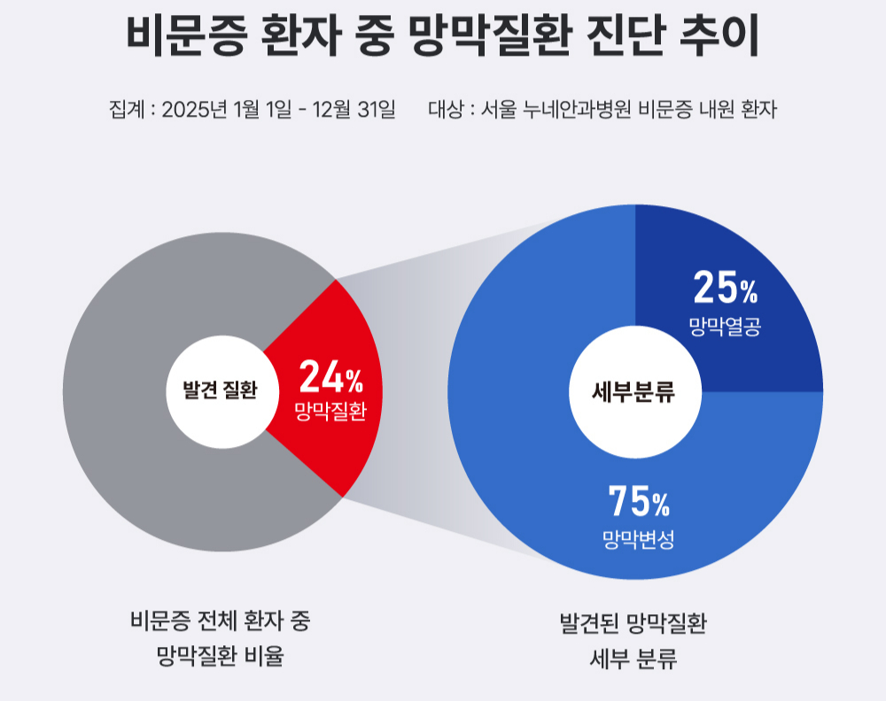 /자료=누네안과병원