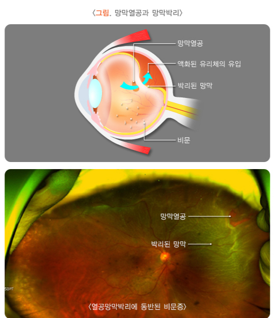 /자료=국가건강정보포털