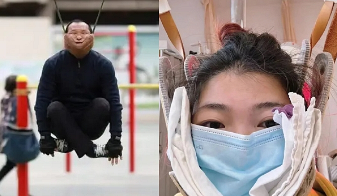 중국 청년층 사이에서 경추 견인 치료를 모방한 이른바 '목 매달기 운동'이 유행하면서 현지 의료진이 척수 손상 위험을 경고하고 나섰다. /사진=웨이보