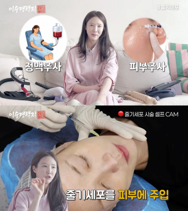 배우 이수경이 노화 방지를 위해 줄기세포, 성장호르몬 주사를 맞는다고 고백했다./사진=유튜브 채널 '이수경력직'