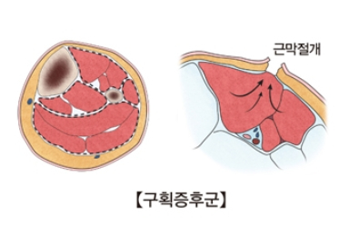 /자료=서울아산병원