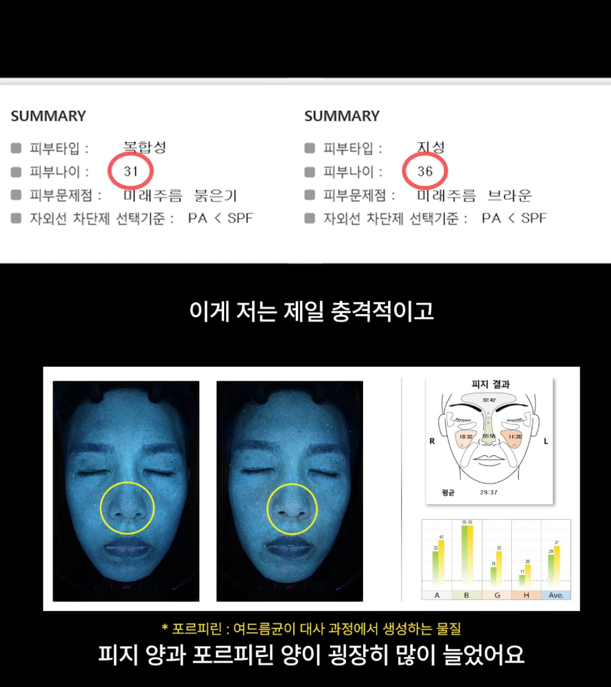 '피부 망치기 챌린지'를 위해 자극적인 식단을 하는 이승주 원장 /사진=유튜브 채널 '피친남 이승주' 캡처