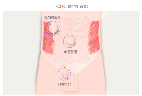 /자료=국가건강정보포털