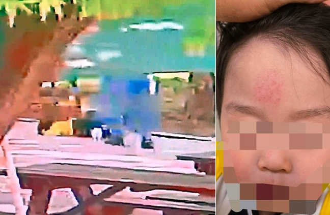 인천 한 공원에서 2살 아이가 성인 남성에게 폭행당하는 사건이 발생해 경찰이 수사에 나섰다./사진=피해자 측 SNS