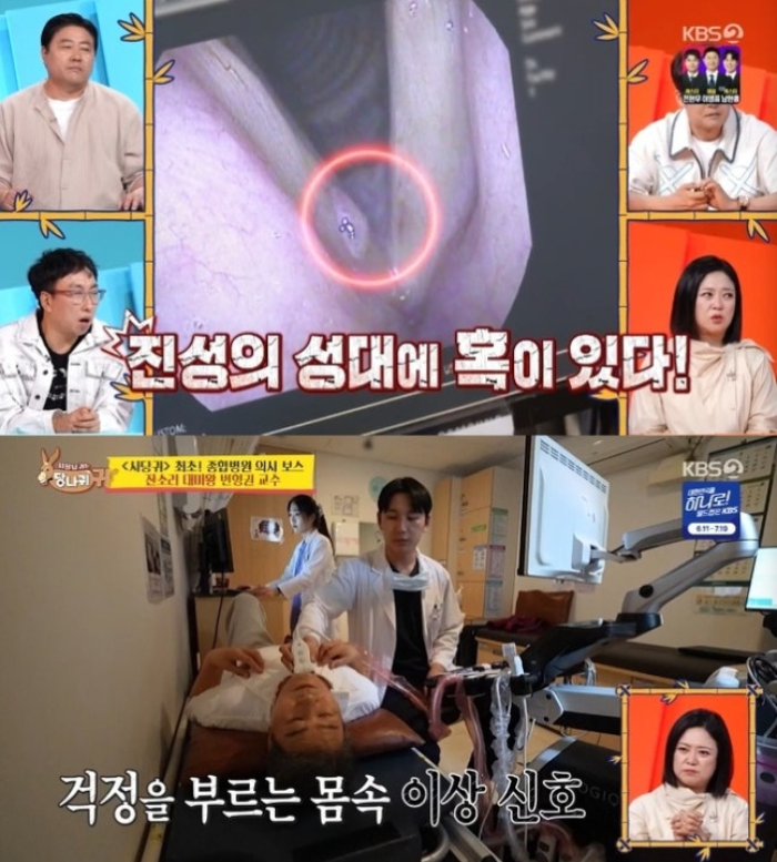 의사는 "생각보다 목소리가 안 좋을 수 있겠다는 생각이 든다. 오른쪽 성대 앞쪽에 혹이 하나 있다"고 진단했다.   그러면서 "진성 선생님은 수술이 필요한 것 같긴 하다"며 "혹 정체는 5㎜ 정도 되는 단순 물혹이다. 물혹 제거 수술은 간단하다. 목에 다른 혹은 없다"고 했다. /사진=KBS2 '사장님 귀는 당나귀 귀'