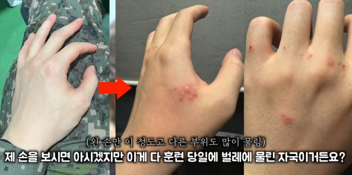 김토르는 벌레에 물린 손 사진을 첨부하면서 "이게 다 훈련 당일 벌레에 물린 자국이다. 진지에 모기도 많고 벌레도 정말 많아 대기하는 것 자체가 힘들었다. 다른 진지에서는 영관급 장교들이 방탄 벗으면 퇴소시킨다고 위협했다더라"라고 주장했다. 김토르는 "저는 이번 훈련을 통해 대한민국 군대가 왜 욕을 먹는지 알게 됐다. 이런 식으로 몸 상태가 어떨지도 모르는 예비군에게 갑자기 30도 날씨에 강도 높은 훈련을 진행하면 사고가 발생할 거라는 사실을 몰랐을까"라고 지적했다. /사진=김토르 유튜브 채널 캡처