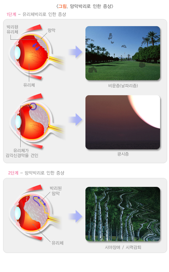 /자료=국가건강정보포