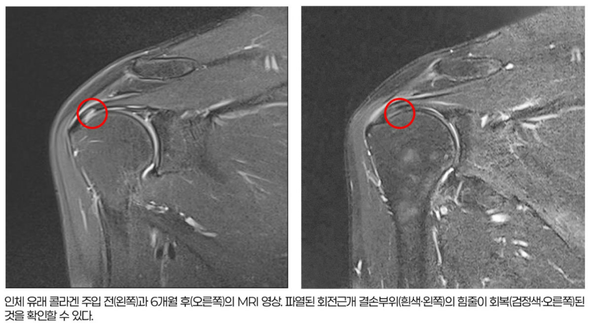 /사진=힘찬병원 관절의학연구소