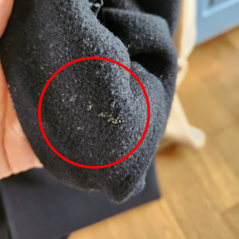세탁 전문 업체에 코트를 맡겼는데 이물질이 그대로 묻은 상태의 옷이 돌아왔다는 사연이 온라인에서 화제다. /사진=온라인 커뮤니티 캡처