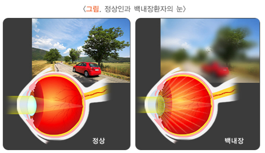 /자료 =국가건강정보포털