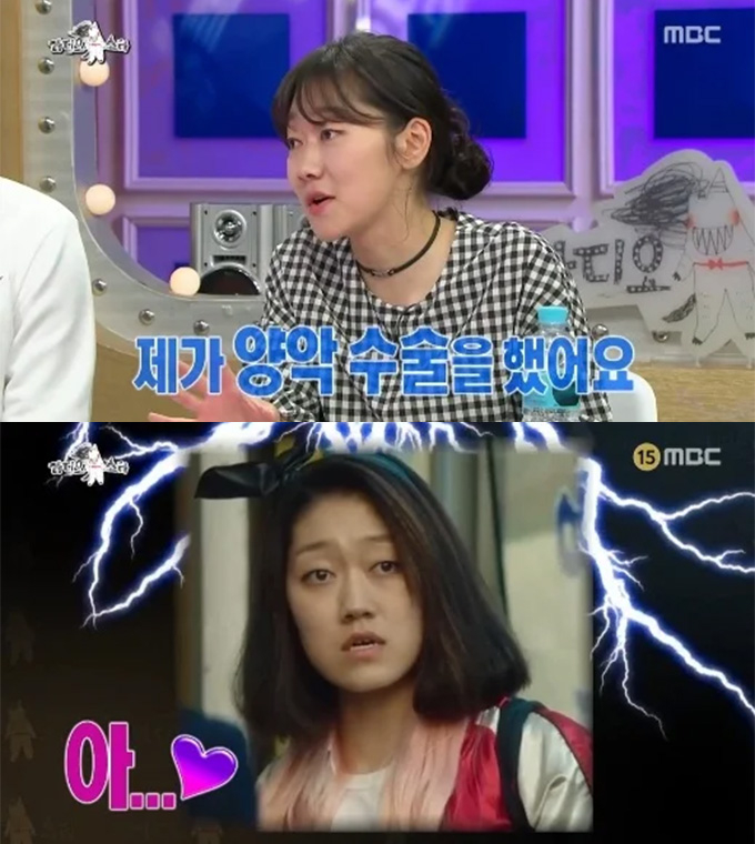 배우 박경혜가 양악수술을 받았다고 고백했다. /사진=MBC '라디오스타' 방송 화면