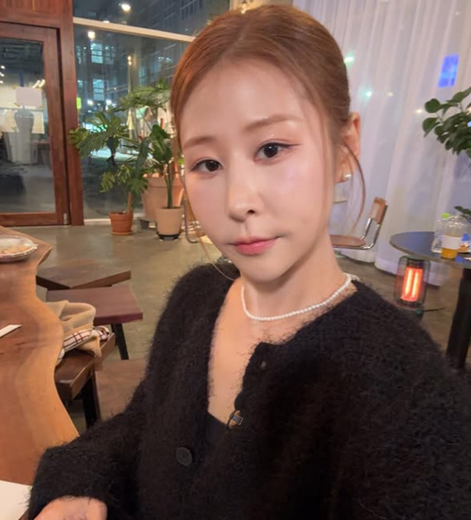 세 차례 코 수술을 고백한 개그우먼 박세미가 최근 다니던 마사지 숍에서 거절 당했다고 밝혔다./사진=박세미 인스타그램