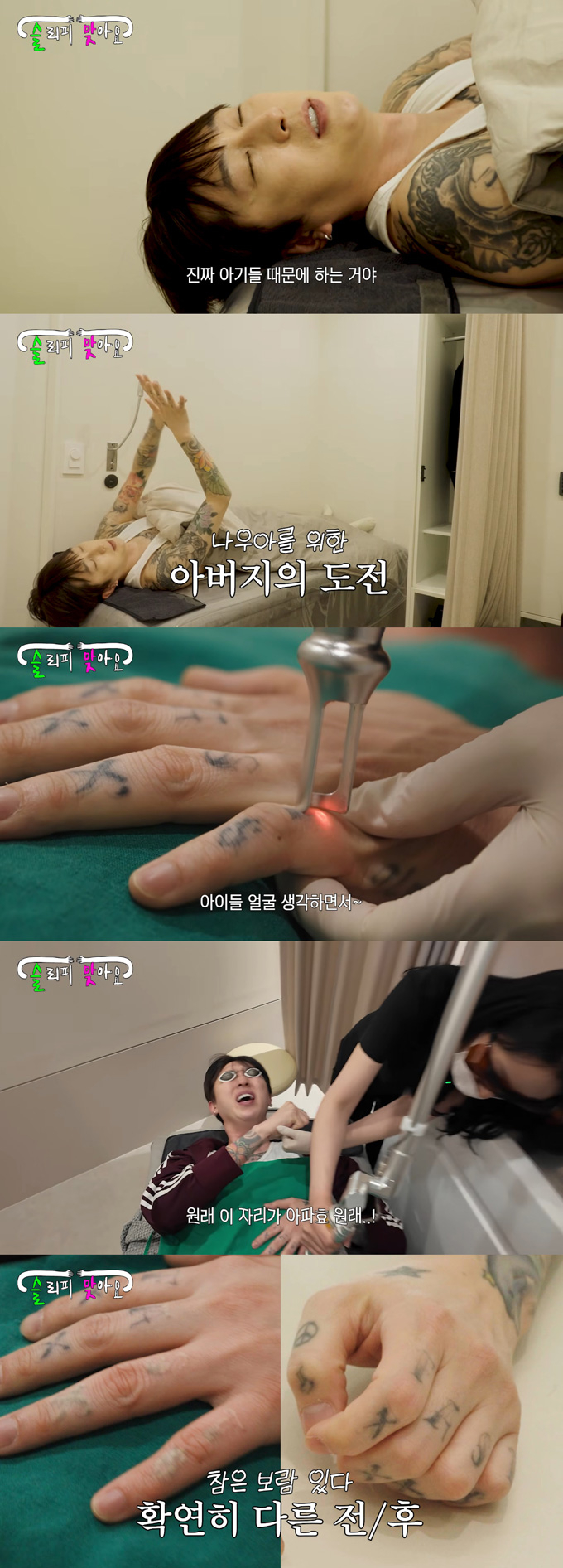 래퍼 겸 방송인 슬리피가 두 아이를 위해 문신 제거를 결심했다. /사진=유튜브 채널 '슬리피맞아요' 영상