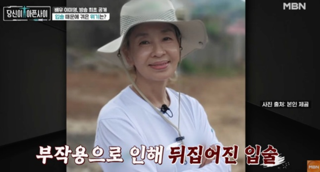 배우 이미영이 공업용 실리콘으로 입술 시술을 받았다가 고통을 겪었던 일화에 대해 털어놨다. /사진=MBN 시사·교양 '당신이 아픈 사이' 캡처