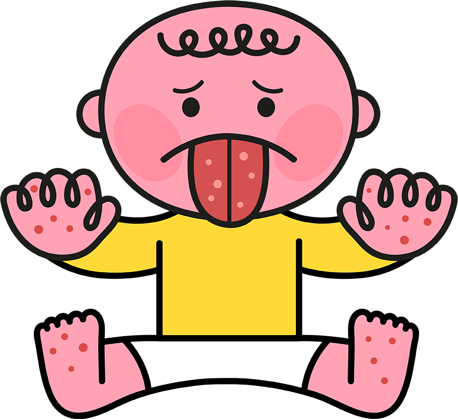 수족구병은 매년 5월부터 환자가 늘기 시작해 6~9월 사이 유행하는 급성 바이러스성 감염 질환이다. 주로 영유아에게 발생하지만 성인도 감염될 수 있어 아이를 돌보는 보호자 역시 손 씻기 등 개인위생 관리에 각별히 신경 써야 한다. 그래픽은 기사 내용과 무관한 참고 이미지. /그래픽=게티이미지뱅크