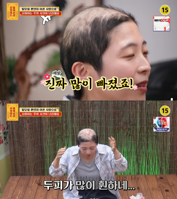 급성 탈모가 생긴 후 주변에서 오해를 받아 고민이라는 30대 여성의 사연이 전해졌다./사진=KBS Joy '무엇이든 물어보살'