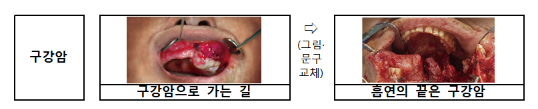제6기 담뱃갑 경고그림 및 문구 표기내용./사진=보건복지부