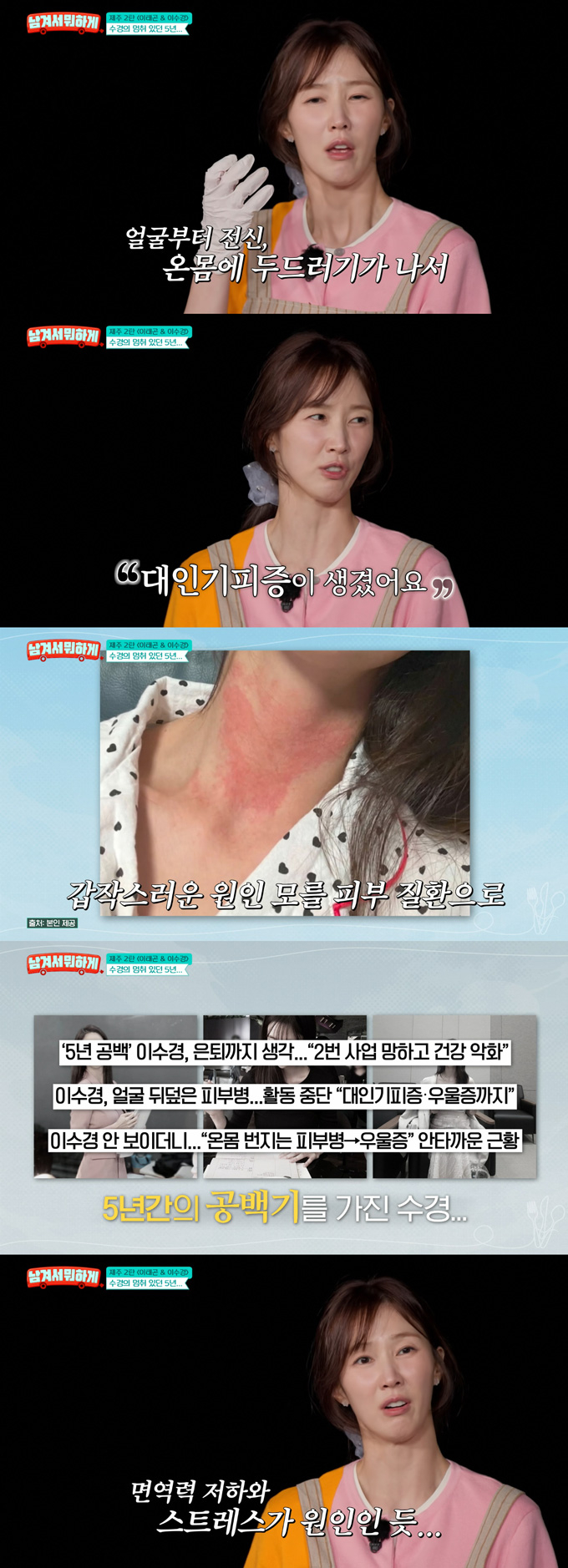 배우 이수경이 피부 질환으로 대인기피증이 생겼다고 고백했다. /사진=tvN STORY '남겨서 뭐하게' 방송 화면