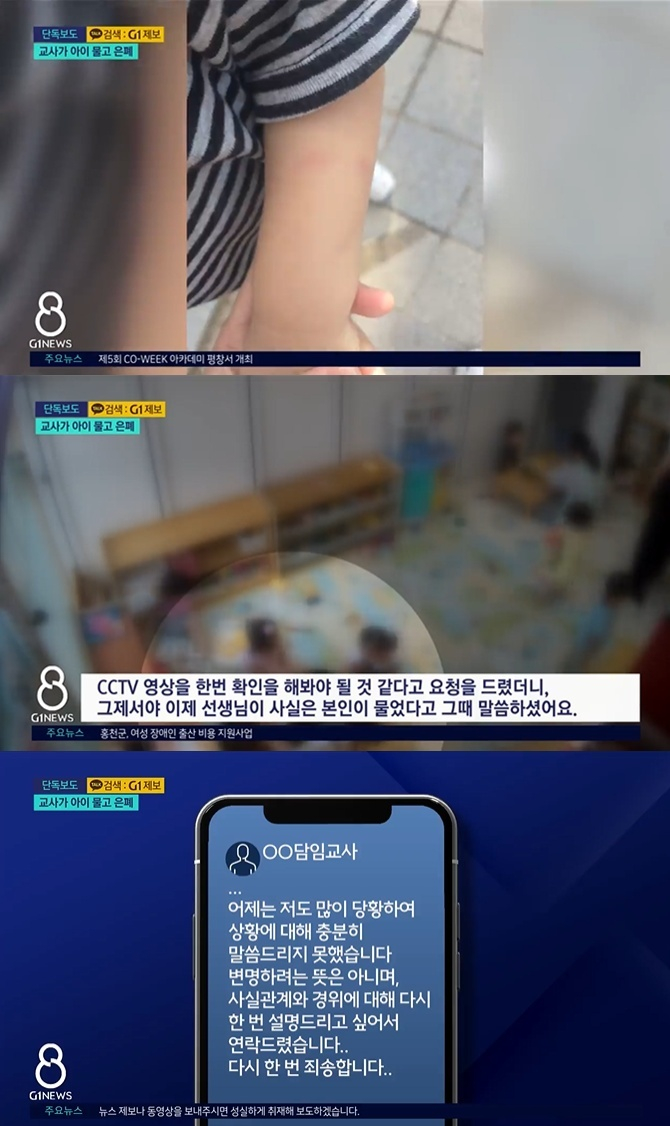 강원도 민영방송 G1뉴스는 지난 22일 강원 춘천의 한 공공형 어린이집에서 벌어진 아동 학대 사건을 보도했다. 해당 보도 화면. /사진=G1 뉴스 캡처