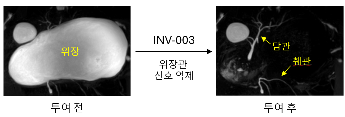 인벤테라의 차세대 경구용 자기공명췌담관조영술(MRCP) 특화 조영제 'INV-003' 투여 전후 MRCP 영상 비교/사진제공=인벤테라
