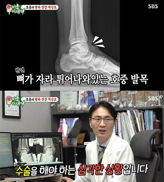 음주운전으로 교통사고를 낸 후 도주한 혐의로 복역 중인 가수 김호중(34)이 가석방 심사를 통과해 출소를 앞둔 가운데 당분간은 건강 회복에 전념할 것으로 보인다. /사진=SBS '미운 우리 새끼' 