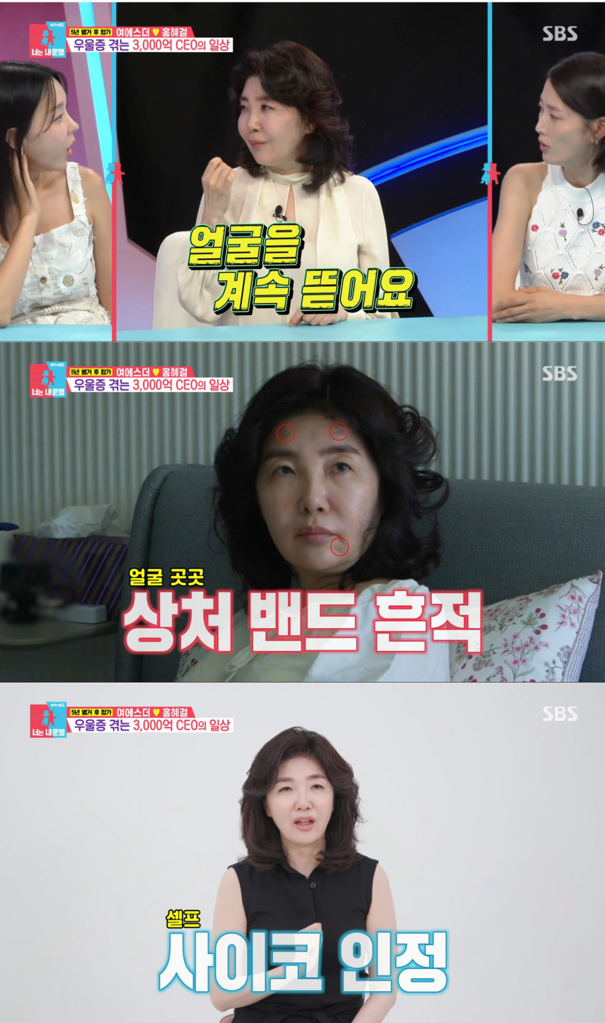 피부를 손톱으로 뜯는 버릇을 고백한 여에스더. /사진=SBS '동상이몽2-너는 내 운명' 캡처